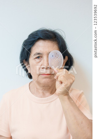 Elderly Woman with eye protective shield after eye surgery. Eye disease, Cataract,  Glaucoma, Age Related Macular Degeneration, Diabetic Retinopathy, Vitreous, Lasik, World Glaucoma day and health 123539692