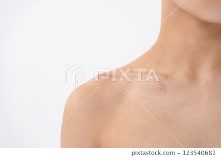 Wound, injury, stitches, scar 123540681