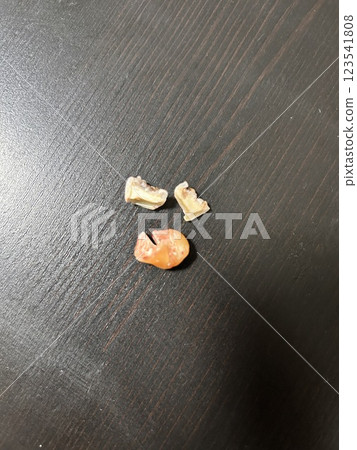 Remove the wisdom tooth that was growing next to it 123541808