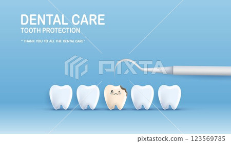 Dental care illustration set. dentists treat tooth decay to avoid pain when chewing. tooth decay treatment concept. remove plaque, treat tooth decay. medical apps, websites and hospital. vector. Dental care illustration set. dentists treat tooth decay to avoid pain when chewing. tooth decay treatment concept. remove plaque, treat tooth decay. medical apps, websites and hospital. vector. 123569785