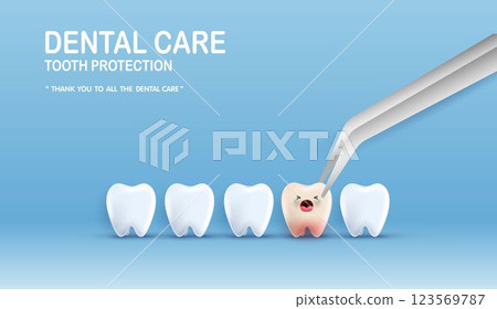 Dental care illustration set. dentists treat tooth decay to avoid pain when chewing. tooth decay treatment concept. remove plaque, treat tooth decay. medical apps, websites and hospital. vector. 123569787