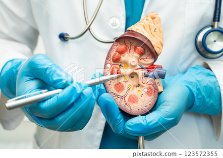Kidney disease, Chronic kidney disease ckd, Doctor hold human model to treat and study in hospital. 123572355