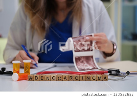 Medical Consultation on the Diagnosis and Treatment Approaches for Adenocarcinoma Cancer 123582682