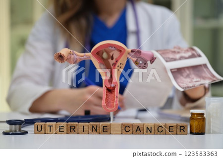 A Comprehensive Overview of Uterine Cancer Insight from a Medical Perspective and Research 123583363