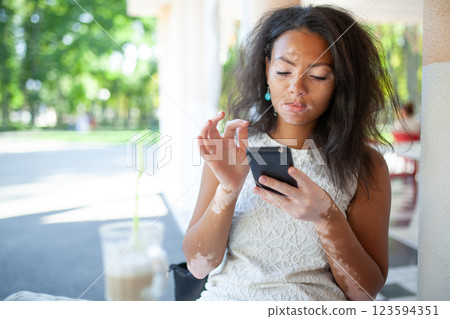 Woman with vitiligo skin disorder using smartphone 123594351
