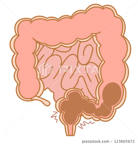 Illustration of rectal constipation 123605672