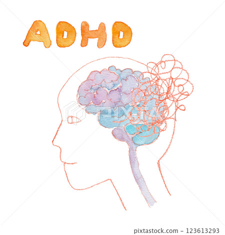 ADHD 大腦水彩插圖 123613293