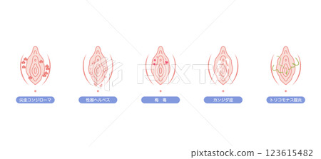 Disorders of the female external genitalia Disorders of the female external genitalia 123615482