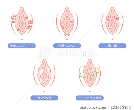 Disorders of the female external genitalia 123615563