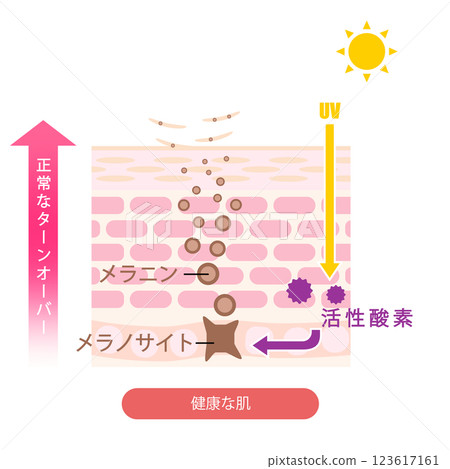 Illustration of blemishes shown on cross-section of skin 123617161