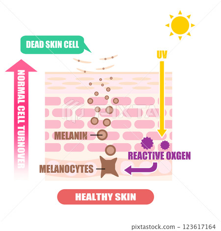 Illustration of blemishes shown on cross-section of skin Illustration of blemishes shown on cross-section of skin 123617164