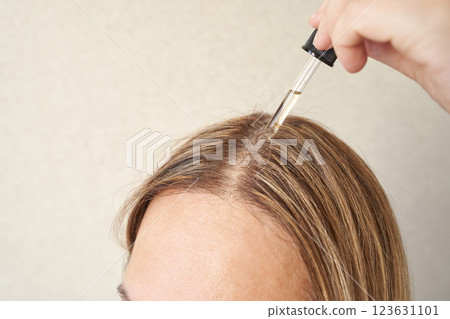 Caucasian female applying hair serum with dropper for scalp care treatment 123631101