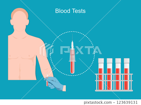 Blood tests can be used to assess health, doctor diagnose. 123639131