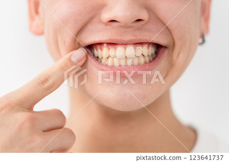 Boys, teens, teeth, dental care 123641737