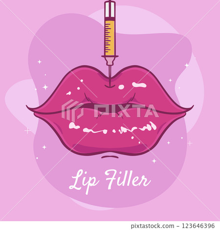 Hand drawn lip filler illustration 123646396