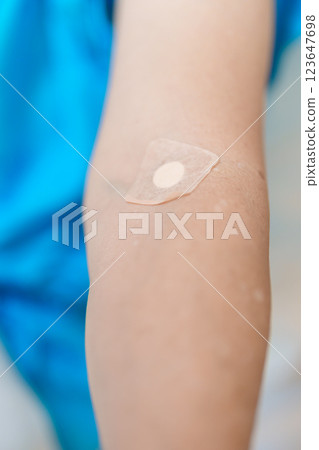 Elderly asian Patient Woman with medical patch plaster after blood test in hospital. Diagnose, illness, treatment, Insurance, Healthcare, medical Examination, Blood donation and World Blood Donor Day 123647698