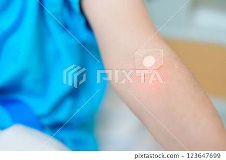 Elderly asian Patient Woman with medical patch plaster after blood test in hospital. Diagnose, illness, treatment, Insurance, Healthcare, medical Examination, Blood donation and World Blood Donor Day Elderly asian Patient Woman with medical patch plaster after blood test in hospital. Diagnose, illness, treatment, Insurance, Healthcare, medical Examination, Blood donation and World Blood Donor Day 123647699