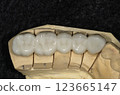 Zirconia model 123665147