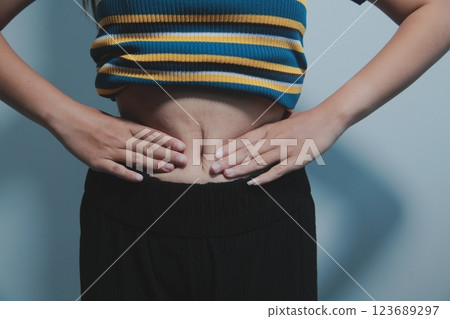 Women body fat belly. Obese woman hand holding excessive belly fat. diet lifestyle concept to reduce belly and shape up healthy stomach muscle. 123689297