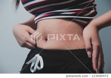 Women body fat belly. Obese woman hand holding excessive belly fat. diet lifestyle concept to reduce belly and shape up healthy stomach muscle. Women body fat belly. Obese woman hand holding excessive belly fat. diet lifestyle concept to reduce belly and shape up healthy stomach muscle. 123690472