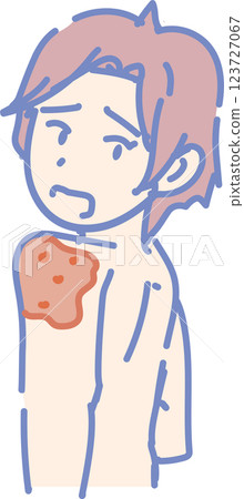 Shingles image_young man Shingles image_young man 123727067