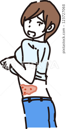 Shingles image_Young people Shingles image_Young people 123727068