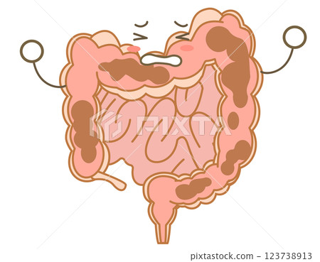 大腸便秘的字符說明 123738913