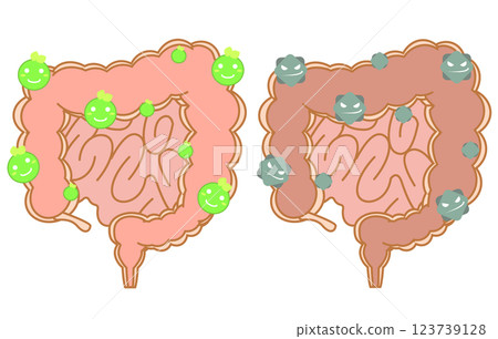 大腸以好菌為主,大腸以壞菌為主 大腸以好菌為主,大腸以壞菌為主 123739128