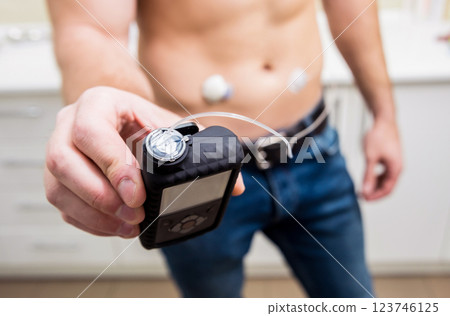 Diabetic man with an insulin pump connected in his abdomen and keeping the insulin pump 123746125