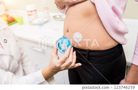 Doctor install patient insulin catheter for a simple injection of insulin. Diabetes concept Doctor install patient insulin catheter for a simple injection of insulin. Diabetes concept 123746259