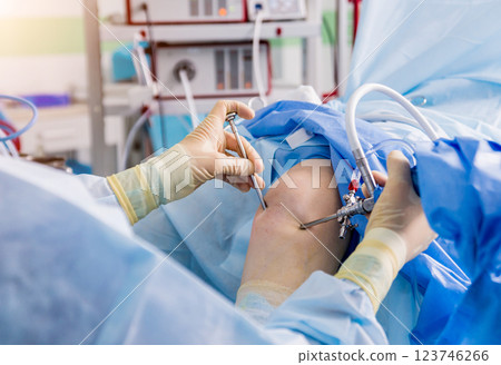Arthroscope surgery. Orthopedic surgeons in teamwork in the operating room  123746266