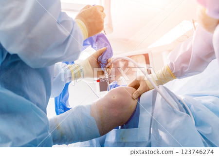 Arthroscope surgery. Orthopedic surgeons in teamwork in the operating room  123746274