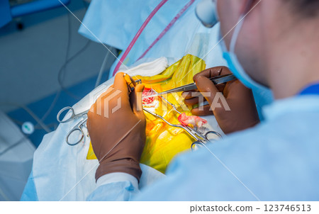 Brain surgery. Group of surgeons in operating room with surgery equipment. Brain surgery. Group of surgeons in operating room with surgery equipment. 123746513