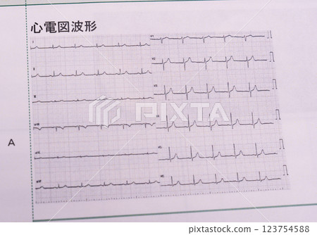 Health checkup results and numerical values: blood pressure, metabolic rate, blood, good and bad cholesterol, gamma GTP, etc. 123754588
