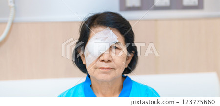 Elderly Woman with eye protective shield after eye surgery. Eye disease, Cataract, Glaucoma, Age Related Macular Degeneration, Diabetic Retinopathy, Vitreous, Lasik, World Glaucoma day and health Elderly Woman with eye protective shield after eye surgery. Eye disease, Cataract, Glaucoma, Age Related Macular Degeneration, Diabetic Retinopathy, Vitreous, Lasik, World Glaucoma day and health 123775660