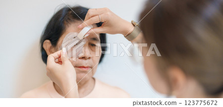 Senior Woman during eye protecting by shield after eye surgery. Eye disease, Cataract, Glaucoma, Age Related Macular Degeneration, Diabetic Retinopathy, Vitreous, Lasik, World Glaucoma day and health Senior Woman during eye protecting by shield after eye surgery. Eye disease, Cataract, Glaucoma, Age Related Macular Degeneration, Diabetic Retinopathy, Vitreous, Lasik, World Glaucoma day and health 123775672