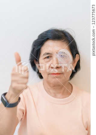 Elderly Woman with eye protective shield after eye surgery. Eye disease, Cataract, Glaucoma, Age Related Macular Degeneration, Diabetic Retinopathy, Vitreous, Lasik, World Glaucoma day and health Elderly Woman with eye protective shield after eye surgery. Eye disease, Cataract, Glaucoma, Age Related Macular Degeneration, Diabetic Retinopathy, Vitreous, Lasik, World Glaucoma day and health 123775673
