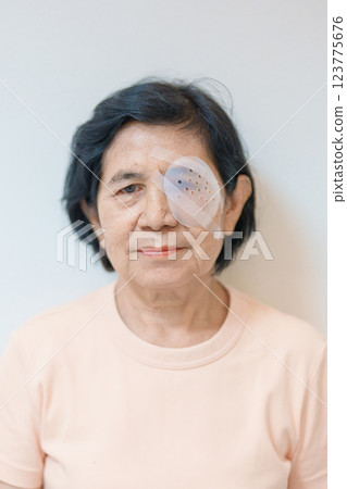 Elderly Woman with eye protective shield after eye surgery. Eye disease, Cataract, Glaucoma, Age Related Macular Degeneration, Diabetic Retinopathy, Vitreous, Lasik, World Glaucoma day and health Elderly Woman with eye protective shield after eye surgery. Eye disease, Cataract, Glaucoma, Age Related Macular Degeneration, Diabetic Retinopathy, Vitreous, Lasik, World Glaucoma day and health 123775676