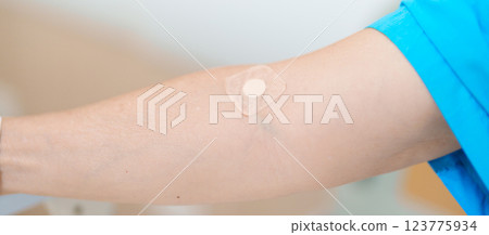 Elderly asian Patient Woman with medical patch plaster after blood test in hospital. Diagnose, illness, treatment, Insurance, Healthcare, medical Examination, Blood donation and World Blood Donor Day 123775934