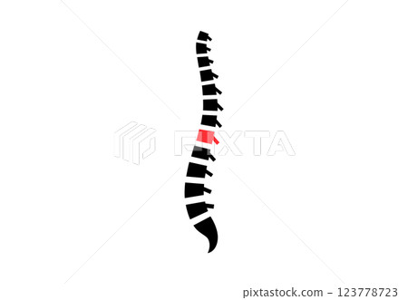Spine disease pain 123778723