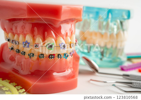 Orthodontic ligatures rings and ties, elastic rubber bands on orthodontic braces, model for dentist studying about dentistry. Orthodontic ligatures rings and ties, elastic rubber bands on orthodontic braces, model for dentist studying about dentistry. 123810568