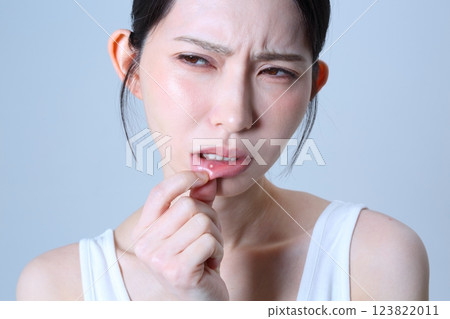 Image of a woman suffering from stomatitis 123822011