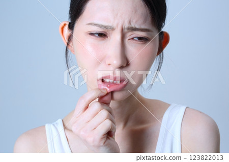 Image of a woman suffering from stomatitis 123822013