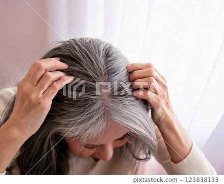 AI-generated woman suffering from thinning hair AI-generated woman suffering from thinning hair 123838133