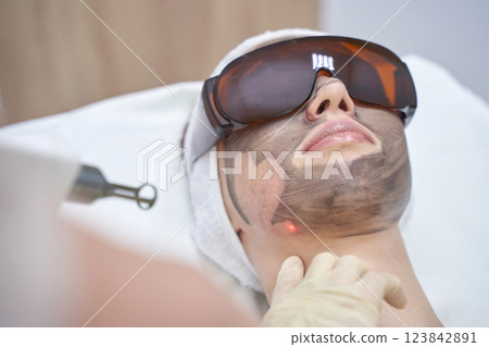 Young caucasian female undergoing laser skin treatment wearing protective goggle 123842891