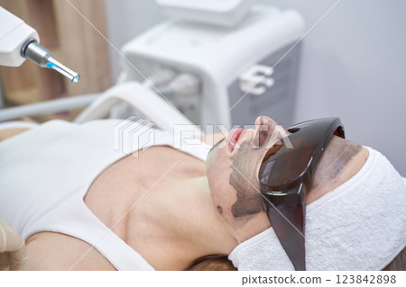 Asian female undergoing laser skin treatment in clinic wearing protective 123842898