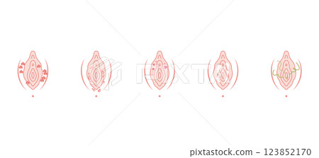 女性外生殖器疾病 女性外生殖器疾病 123852170