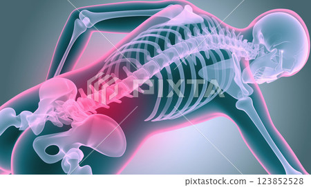 "Visual representation of lower back pain: A tangible image of pain and discomfort in the lumbar region." <AI-generated material> 123852528