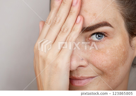 Woman's face with freckles or age spots. Age spots on the face. Beautiful blue eye close up photo Woman's face with freckles or age spots. Age spots on the face. Beautiful blue eye close up photo 123865805