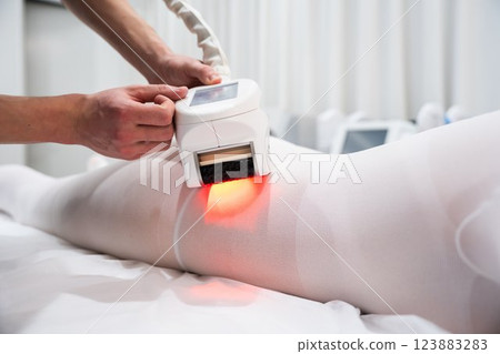 Innovative treatment using a laser device on a patients leg in a clinic 123883283